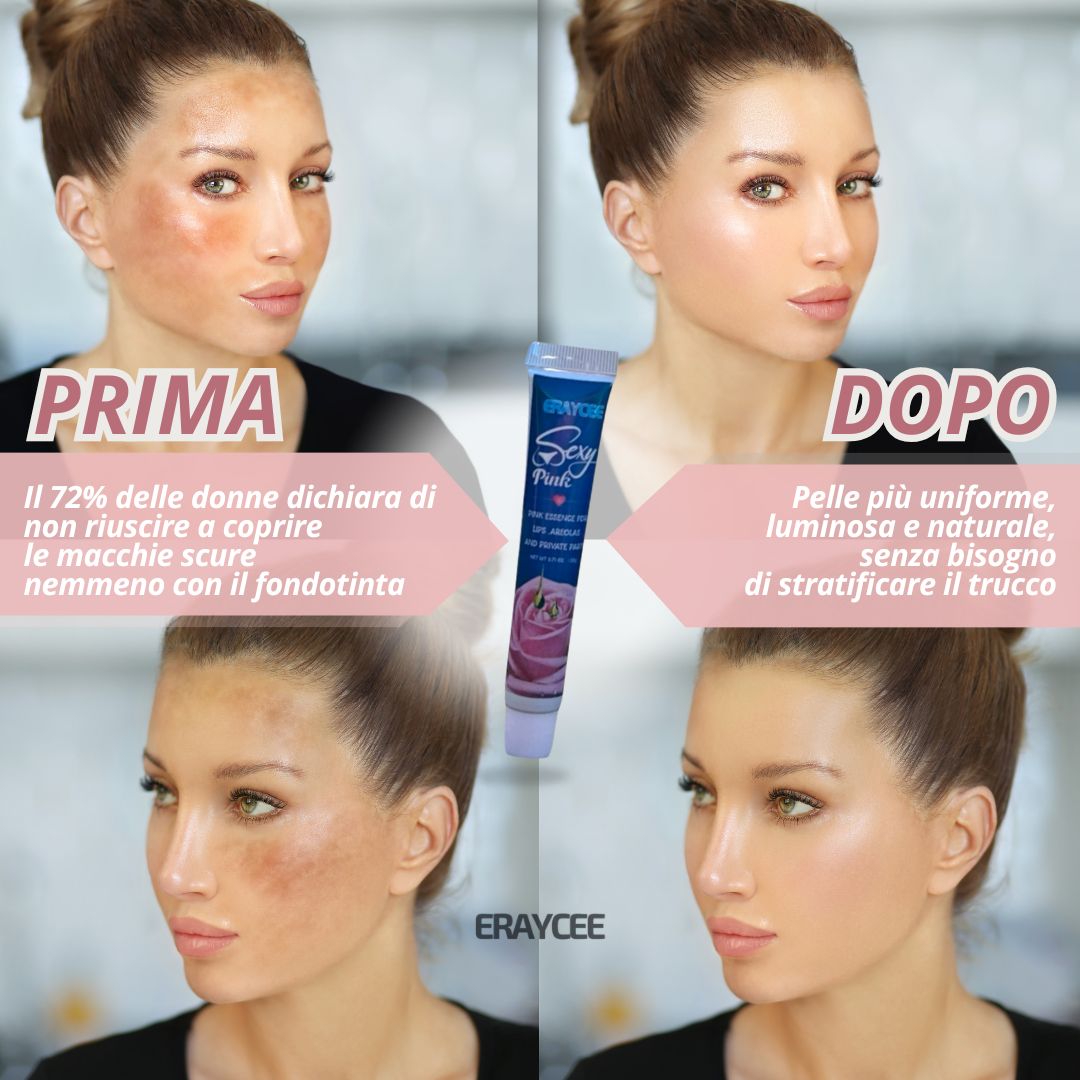 Sexy Pink Crema Schiarente